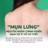 Sữa Tắm Tràm Trà Giảm Mụn Lưng Và Body Neoacnes 250Ml - Neo Acnes - Ảnh 5