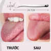 Dụng Cụ Cạo Lưỡi, Vệ Sinh Lưỡi - Ảnh 3