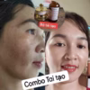 Combo Kem Trị Nám , Kem Dưỡng Hổ Trợ Tái Tạo Da Đốm Nâu, Đồi Mồi Gia Truyền - Gdn - Ảnh 6