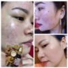 Combo Kem Trị Nám , Kem Dưỡng Hổ Trợ Tái Tạo Da Đốm Nâu, Đồi Mồi Gia Truyền - Gdn - Ảnh 5
