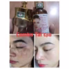 Combo Kem Trị Nám , Kem Dưỡng Hổ Trợ Tái Tạo Da Đốm Nâu, Đồi Mồi Gia Truyền - Gdn - Ảnh 9