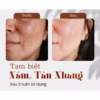 Kem Silex Ngày & Đêm Thâm Nám Sạm Tàn Nhang Làm Trắng Da Mờ Nếp Nhăn - Gdn - Ảnh 3