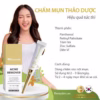 [Mua 1 Tặng 1] Combo Hết Mụn Hết Thâm Sạm - Ảnh 8