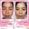 Sữa Rửa Mặt Trắng Da Ngăn Ngừa Mụn Alpha Arbutin Lollagen Foaming Cleanser Thái Lan 120Ml - Gdn - Ảnh 3