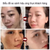 Kem Melanin Dr.Dmy 20G Xóa Tàn Nhang Làm Trắng Da Đốm Đen Giữ Ẩm - Gdn - Ảnh 6
