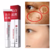 Kem Melanin Dr.Dmy 20G Xóa Tàn Nhang Làm Trắng Da Đốm Đen Giữ Ẩm - Gdn - Ảnh 4