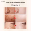 Kem Melanin Dr.Dmy 20G Xóa Tàn Nhang Làm Trắng Da Đốm Đen Giữ Ẩm - Gdn - Ảnh 7