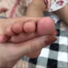 Kem Thảo Dược Bôi Ngoài Da: Nứt Nẻ, Nấm Ngứa, Vảy Nến, Á Sừng Cực Kỳ Hiệu Quả - Ctb798 - Ảnh 12