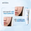 Combo 2 Tuýp Gel Giảm Mụn, Thâm Sẹo Mụn & Cải Thiện Da Dầu, Mụn Neothera Acnes Gel - Ảnh 8