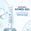 Combo 2 Tuýp Gel Giảm Mụn, Thâm Sẹo Mụn & Cải Thiện Da Dầu, Mụn Neothera Acnes Gel - Ảnh 9