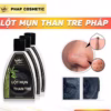 Lột Mụn Than Tre Size Lớn 200Gram Pháp Cosmetic - Gdn - Ảnh 4