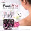 Gel Mờ Sẹo Fobe Scar 10G- Fobelife - Ảnh 5