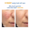 Gel Giảm Mụn, Thâm Sẹo Mụn & Cải Thiện Da Dầu, Mụn Neothera Acnes Gel 15Ml (Tuýp) - Ảnh 4