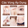 Kem West 20G Làm Mờ Sẹo, Giảm Sẹo Mụn Phục Hồi Sẹo Rỗ Thâm, Vết Bỏng Làm Mờ Vết Rạn Da Khi Mang Thai - Gdn - Ảnh 3