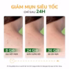 Xịt Mụn Lưng Neoacnes Hỗ Trợ Giảm Mụn, Mờ Thâm 100Ml - Ảnh 7