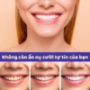 Gel Gaolibai Trắng Răng, Đánh Bật Cao Răng Hổ Trợ Làm Trắng Răng Nhanh Chóng, Khử Hôi Thơm Miệng - Gdn - Ảnh 3