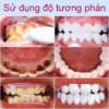 Gel Gaolibai Trắng Răng, Đánh Bật Cao Răng Hổ Trợ Làm Trắng Răng Nhanh Chóng, Khử Hôi Thơm Miệng - Gdn - Ảnh 5