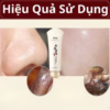 Gel Lột Mụn, Mụn Cám, Mụn Đầu Đen Peel Off Mask Đông Y Thảo Dược - Gdn - Ảnh 4