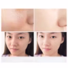 Gel Lột Mụn, Mụn Cám, Mụn Đầu Đen Peel Off Mask Đông Y Thảo Dược - Gdn - Ảnh 2