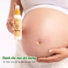 Dầu Chống Rạn Săn Chắc Da Wonmom 70G - Ảnh 4