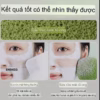 Miếng Mút Rửa Mặt Bọt Biển ( Sét 3 Miếng ) - Ảnh 7