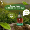 Serum Dành Cho Da Mụn Herbal Anti 50Ml - Acne Serum - Mộc Thiên Hương - Ảnh 10
