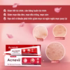 Kem Trị Mụn Đầu Đen, Mụn Cám Acnevir (Đỏ) - Santafa - Ảnh 2
