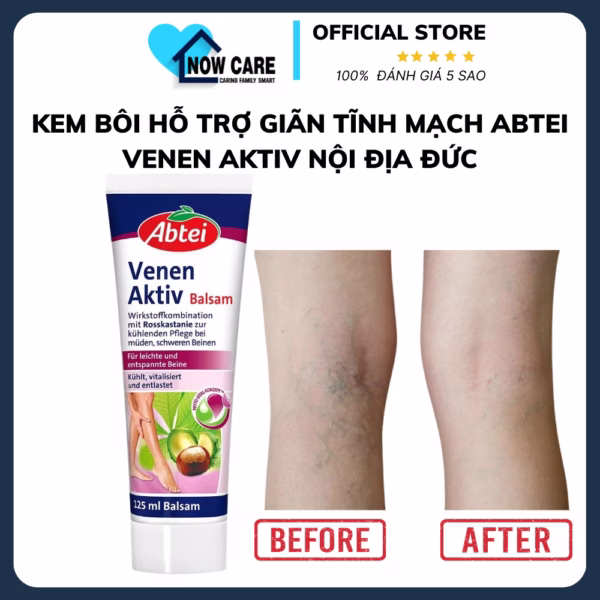 Kem Bôi Giãn Tĩnh Mạch Venen Aktiv 125Ml - Abtei