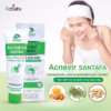 Combo Trị Mụn Sữa Rửa Mặt 100G + Kem Mụn Đỏ 15G + Kem Trị Thâm 15G - Fobelife - Ảnh 3