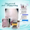 Combo Trị Mụn Acneskin Care - Soo Young - Ảnh 14