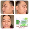 Melasma Green 21 - Phan An Green - Ảnh 14
