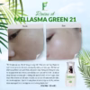 [Combo] 1 Hộp Viên Uống Trắng Da Nine’S Beauty + 1 Melasma Green 21 - Phan An Green - Ảnh 14