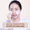 Combo 2 Nước Hoa Hồng Toner Hoa Cúc & Aha Ngừa Mụn, Giảm Dầu (250Ml/Chai) - Milaganics - Ảnh 8