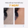 Xà Phòng Giảm Mụn Lưng Thiên Nhiên Rau Má & Cúc La Mã 75G - Neo Acnes - Ảnh 7