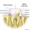 Hộp Tăm Chỉ Nha Khoa Tiệt Trùng Sợi Chỉ Vệ Sinh Răng Miệng 1 Hộp 50 Chiếc Gd099 - Lady'S Passion - Ảnh 12