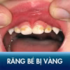 Gel Ngừa Sâu Răng, Mòn Răng, Mủn Răng Vecni Fluor - Anamelast - Ảnh 5