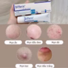 Kem Trị Mụn Differin Pháp - Galderma - Ảnh 3