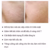 Serum Se Khít Lỗ Chân Lông, Dưỡng Trắng Da Niacinamide - Balea - Ảnh 4