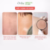 (Chai) - Sữa Tắm Oriss Giảm Mụn Lưng Làm Mờ Vết Thâm, Sẹo Mụn Cho Da Sáng Mịn 300Ml - Oribe - Ảnh 6