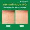 Gel Rửa Mặt Tạo Bọt Troubless Dịu Nhẹ Hỗ Trợ Kiểm Soát Nhờn Mụn, Làm Sạch Sâu 120Ml - Ảnh 5