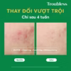 Toner Pad Bông Tẩy Trang Troubless Hỗ Trợ Tẩy Tế Bào Chết, Làm Sạch Sâu, Giảm Mụn, Làm Sáng Da (60 Miếng) - Ảnh 2