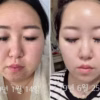 1 Gói Serum Tinh Chất Ohui Prime Advancer Ampoule Serum 1Ml - Ohui - Ảnh 3