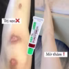 Kem Trị Sẹo Nhật Bản 0.1% - Gentacin - Ảnh 2