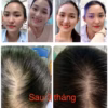 Xịt Mọc Tóc Minoxidil 2% Pháp - Bailleul - Ảnh 3