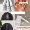 Xịt Mọc Tóc Minoxidil 2% Pháp - Bailleul - Ảnh 4