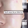 Bha 2% Ngừa Mụn, Kháng Viêm Giảm Dầu Nhờn, Thu Nhỏ Lỗ Chân Lông - Obagi - Ảnh 5