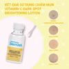 Lotion Chấm Mụn Vitamin C Giảm Mụn Nhanh Sau 1 Đêm Cho Da Mụn Thâm Vitamin C Dark Spot Brightening Lotion 30Ml - Bye Bye Blemish - Ảnh 4