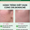 Kem Giảm Mụm Thẩm Dr.Skinacne 15G Kt-Gdn - Ảnh 3