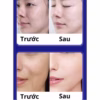 Kem Giảm Nám, Chống Nhăn Và Trẻ Hóa Da Ucm Nhật Bản - Gdn - Ảnh 4