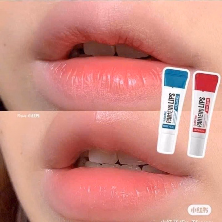 Son Dưỡng Mediheal Giảm Thâm Môi Và Nứt Nẻ Môi Hàn Quốc 10Ml - Gdn - Ảnh 7